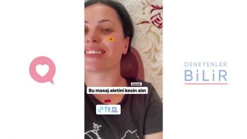 Özel: [ID: OMdFvn9dUPs] Youtube Automatic